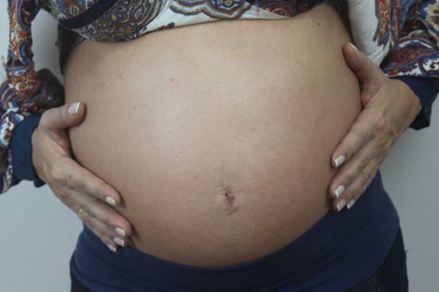 Mãe de gêmeos com 34 semanas de gravidez